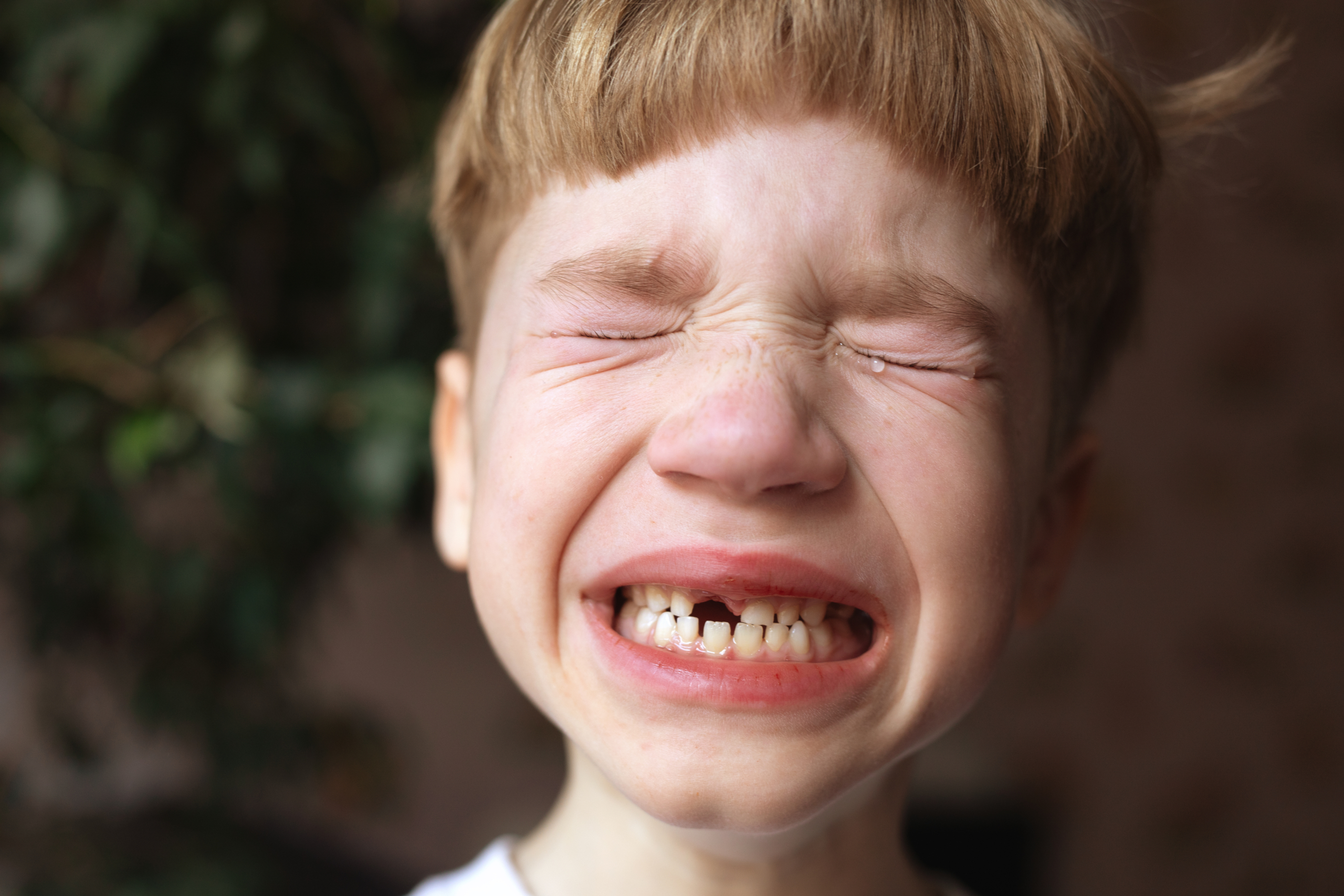 little boy crying as front tooth is knocked out