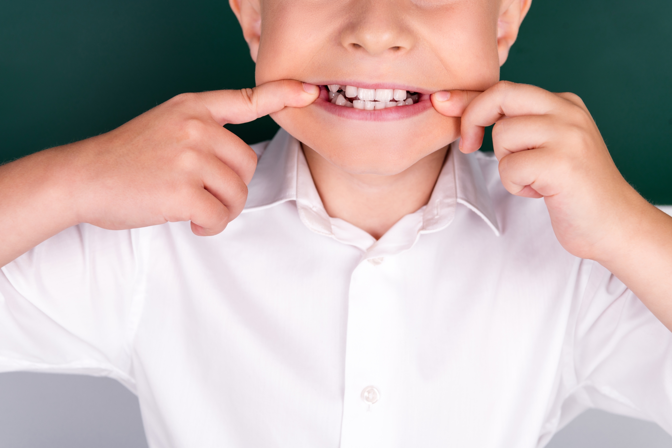 little boy showing off his smile with missing teeth